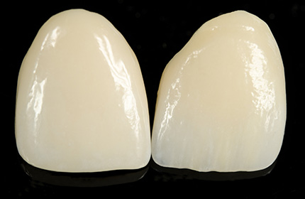 歯科技工士と連携して高品質の人工歯をご提供します